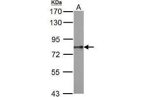 Image no. 3 for anti-DEAD (Asp-Glu-Ala-Asp) Box Polypeptide 3, X-Linked (DDX3X) (Center) antibody (ABIN2856700)