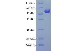 Image no. 1 for tyrosylprotein Sulfotransferase 2 (TPST2) (AA 26-377) protein (His-SUMO Tag) (ABIN5710542)