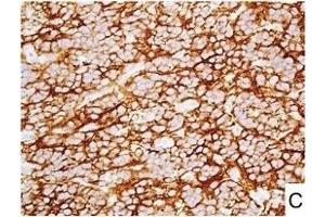 Image no. 5 for anti-L1 Cell Adhesion Molecule (L1CAM) (AA 1-1120) antibody (ABIN1995799)
