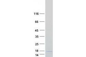 Image no. 1 for LYR Motif Containing 4 (LYRM4) protein (Myc-DYKDDDDK Tag) (ABIN2725049)