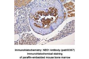 Image no. 2 for anti-NLR Family, Pyrin Domain Containing 2 (NLRP2) (Internal Region) antibody (ABIN363674)
