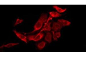Image no. 1 for anti-TAS2R39 (TAS2R39) (Internal Region) antibody (ABIN6259424)