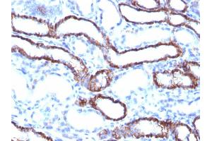 Image no. 7 for anti-Cadherin-16 (CDH16) antibody (ABIN6939019)