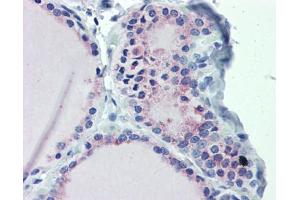 Image no. 8 for anti-GNAS Complex Locus (GNAS) (N-Term) antibody (ABIN2775542)
