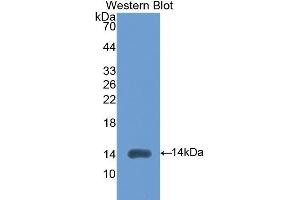 anti-Left-Right Determination Factor 2 (LEFTY2) (AA 245-356) antibody