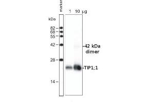 Image no. 1 for anti-Tax1 (Human T-Cell Leukemia Virus Type I) Binding Protein 3 (TAX1BP3) antibody (ABIN349666)