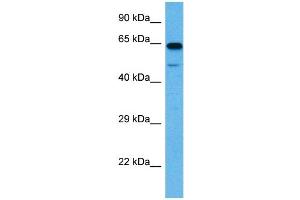 Image no. 6 for anti-Solute Carrier Family 1 (Glial High Affinity Glutamate Transporter), Member 2 (SLC1A2) (N-Term) antibody (ABIN2778148)