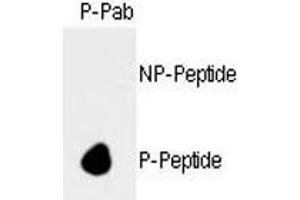 Image no. 2 for anti-Retinoblastoma Protein (Rb Protein) (pSer788) antibody (ABIN3032467)