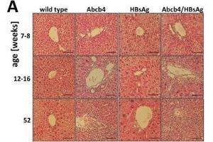 Image no. 3 for anti-Hepatitis B Virus Surface Antigen (HBsAg) antibody (ABIN285516)