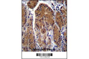 Image no. 2 for anti-Testis-Specific Serine Kinase 6 (TSSK6) (AA 198-228), (C-Term) antibody (ABIN656396)