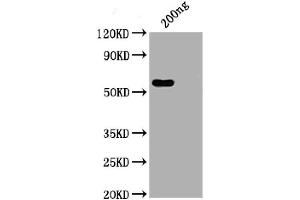 WB of recombinant SARS-CoV-2 Nucleocapsid antibody (ABIN6952664)