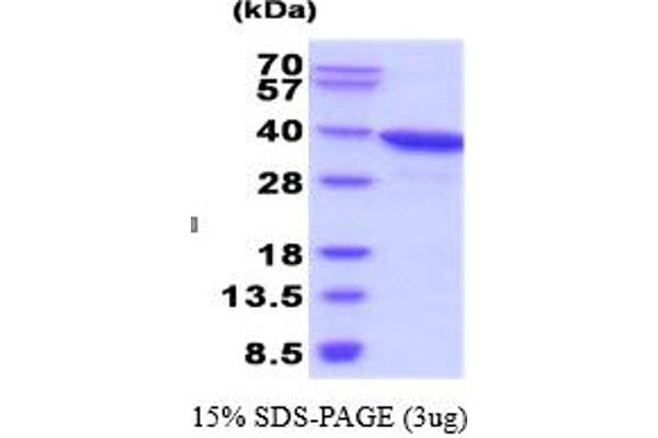 AKR1C3 Protein (AA 1-323, Isoform 1)