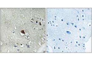 Image no. 1 for anti-Dishevelled, Dsh Homolog 3 (Drosophila) (DVL3) (AA 326-375) antibody (ABIN1535326)