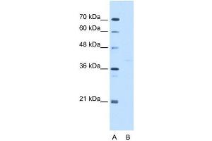 Image no. 3 for anti-GDP-Mannose Pyrophosphorylase B (GMPPB) (C-Term) antibody (ABIN629777)