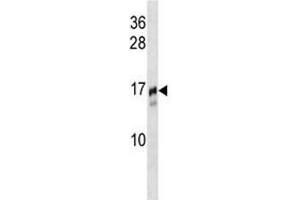 Image no. 1 for anti-Trafficking Protein Particle Complex 2 (TRAPPC2) (AA 11-39) antibody (ABIN3029192)
