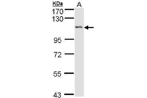 Image no. 2 for anti-Disabled Homolog 2, Mitogen-Responsive phosphoprotein (Drosophila) (DAB2) (C-Term) antibody (ABIN2854661)