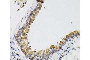 Immunohistochemistry of paraffin-embedded Mouse lung using ARHGEF2 Polyclonal Antibody at dilution of 1:100 (40x lens).