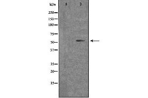 Image no. 2 for anti-Opsin 4 (OPN4) antibody (ABIN6257858)