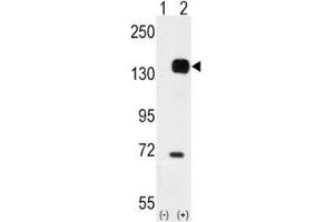 Image no. 4 for anti-TEK Tyrosine Kinase, Endothelial (TEK) (AA 758-789) antibody (ABIN3029103)