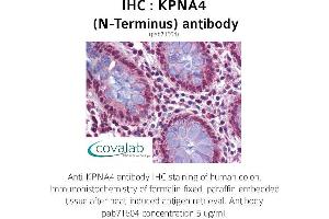 Image no. 2 for anti-Karyopherin (Importin) alpha 4 (KPNA4) (N-Term) antibody (ABIN1736271)