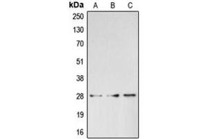 Image no. 1 for anti-Breast Cancer Metastasis Suppressor 1 (BRMS1) (C-Term) antibody (ABIN2704541)