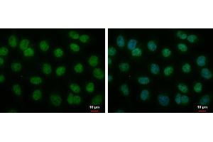 Image no. 3 for anti-Strawberry Notch Homolog 1 (SBNO1) (Center) antibody (ABIN2856024)