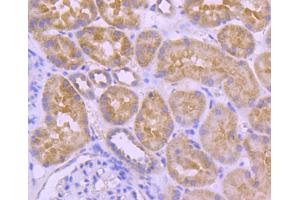 Image no. 1 for anti-V-Raf Murine Sarcoma 3611 Viral Oncogene Homolog (ARAF) antibody (ABIN5557283)