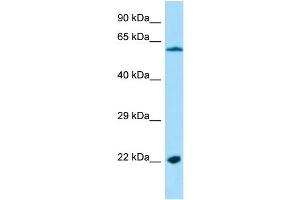Image no. 1 for anti-Mitochondrial Ribosomal Protein L4 (MRPL4) (N-Term) antibody (ABIN2790816)