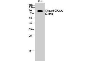 Image no. 1 for anti-Collagen, Type I, alpha 2 (COL1A2) (cleaved), (Gly1102) antibody (ABIN3181801)