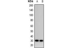 Image no. 1 for anti-Myozenin 2 (MYOZ2) antibody (ABIN3222752)
