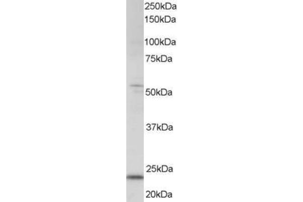 anti-MAX Dimerization Protein 4 (MXD4) (C-Term) antibody