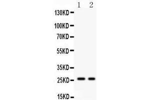 Image no. 2 for anti-Kallikrein-Related Peptidase 4 (KLK4) (AA 31-254) antibody (ABIN3042476)
