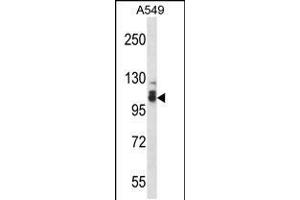 Image no. 1 for anti-SMEK Homolog 2, Suppressor of Mek1 (Dictyostelium) (SMEK2) (AA 720-748), (C-Term) antibody (ABIN5531876)