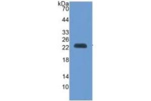 Image no. 5 for Vascular Cell Adhesion Molecule 1 (VCAM1) ELISA Kit (ABIN6730930)