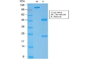 Image no. 4 for anti-Spectrin alpha 1, Erythrocytic (SPTA1) (AA 356-475) antibody (ABIN6940645)