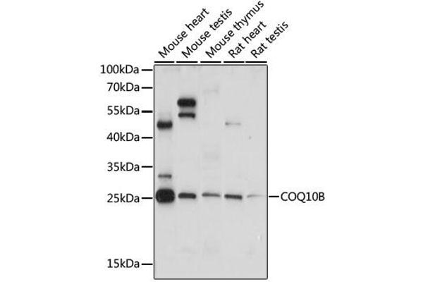 anti-Coenzyme Q10 Homolog B (COQ10B) antibody