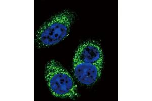 Image no. 2 for anti-Transforming Growth Factor, beta 2 (TGFB2) antibody (ABIN659106)