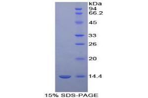 Image no. 1 for D-Aspartate Oxidase (DDO) protein (ABIN3009123)