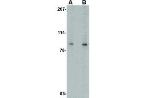 Image no. 1 for anti-Vacuolar Protein Sorting 53 Homolog (VPS53) (C-Term) antibody (ABIN6656861)