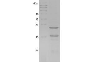 RIPK1 Protein (AA 292-438) (His tag)