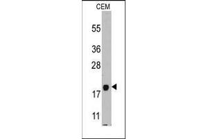 Image no. 2 for anti-Pro-Platelet Basic Protein (Chemokine (C-X-C Motif) Ligand 7) (PPBP) (AA 99-128), (C-Term) antibody (ABIN359713)