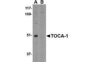 Image no. 2 for anti-Formin Binding Protein 1-Like (FNBP1L) (C-Term) antibody (ABIN501002)