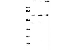 Image no. 3 for anti-Cytoskeleton-Associated Protein 4 (CKAP4) (AA 525-602) antibody (ABIN717506)