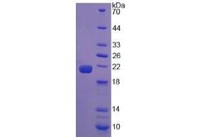 Image no. 1 for Calreticulin (CALR) (AA 18-193) protein (His tag) (ABIN1169989)