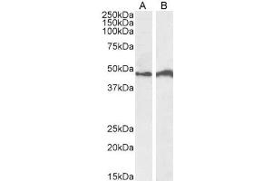 Image no. 2 for anti-Interferon Regulatory Factor 4 (IRF4) (C-Term) antibody (ABIN940553)