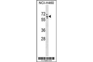 Image no. 1 for anti-Cytochrome P450, Family 4, Subfamily V, Polypeptide 2 (CYP4V2) (AA 496-525), (C-Term) antibody (ABIN1537408)