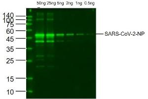 Image no. 1 for anti-SARS-CoV-2 Nucleocapsid (SARS-CoV-2 N) antibody (ABIN6952435)