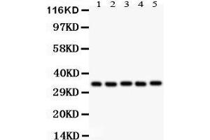 Image no. 2 for anti-Homeobox A11 (HOXA11) (AA 74-245) antibody (ABIN3042454)