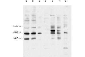 Image no. 1 for anti-Integral Membrane Protein 2B (ITM2B) (N-Term) antibody (ABIN113331)