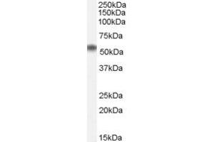 Image no. 1 for anti-ELMO/CED-12 Domain Containing 1 (ELMOD1) (N-Term) antibody (ABIN2787155)